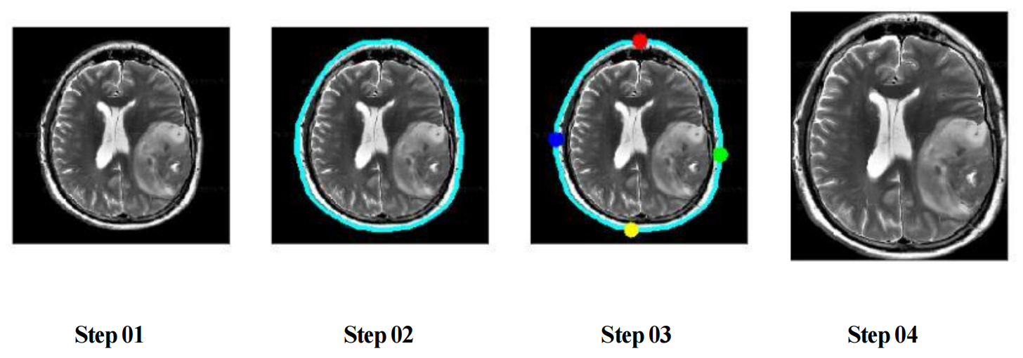 MRI image cropping example